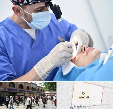 جراح سرطان چشم در بازار تهران