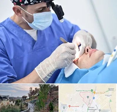 جراح سرطان چشم در باغستان کرج 