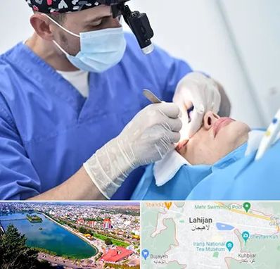 جراح سرطان چشم در لاهیجان