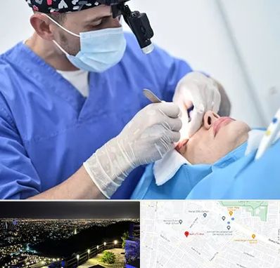 جراح سرطان چشم در هفت تیر مشهد 