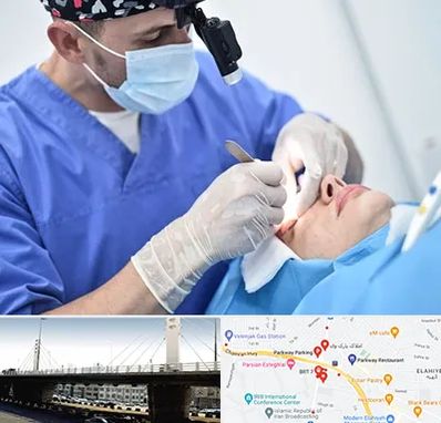 جراح سرطان چشم در پارک وی 