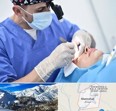 جراح سرطان چشم در شمشک