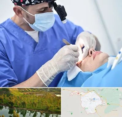 جراح سرطان چشم در بهبهان