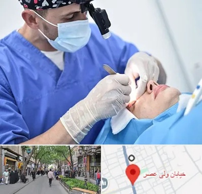 جراح سرطان چشم در ولیعصر شهریار