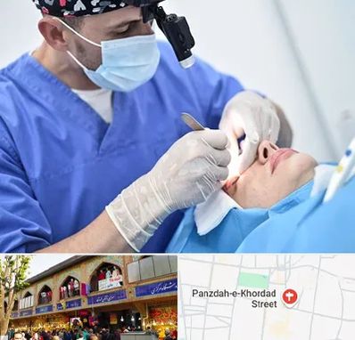 جراح سرطان چشم در 15 خرداد