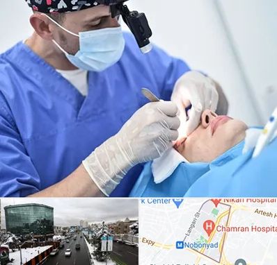 جراح سرطان چشم در اقدسیه 