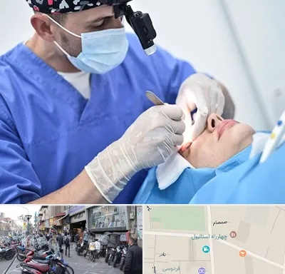 جراح سرطان چشم در چهارراه استانبول