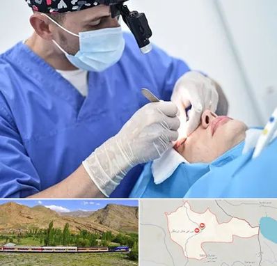 جراح سرطان چشم در خاش