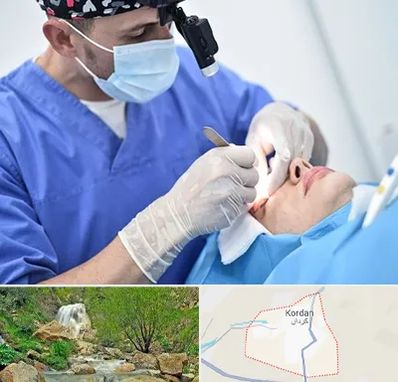 جراح سرطان چشم در کردان