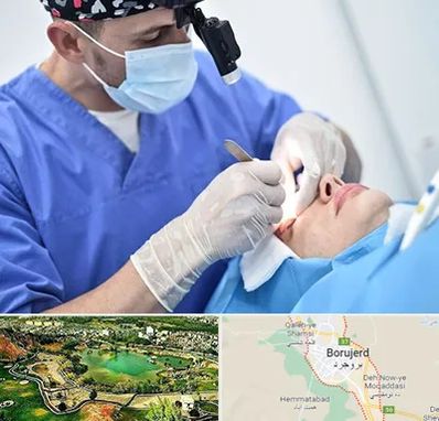 جراح سرطان چشم در بروجرد
