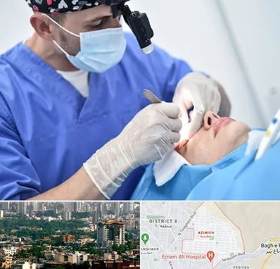 جراح سرطان چشم در عظیمیه کرج 