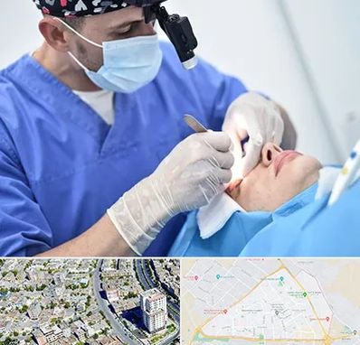 جراح سرطان چشم در قاسم آباد مشهد 