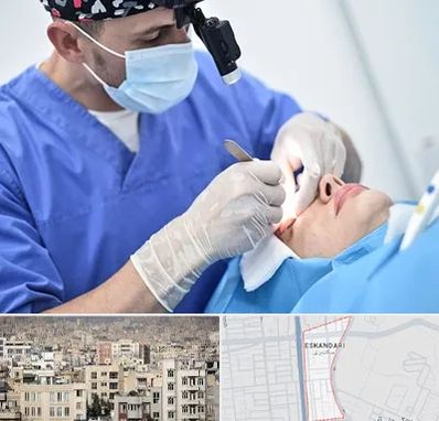 جراح سرطان چشم در اسکندری