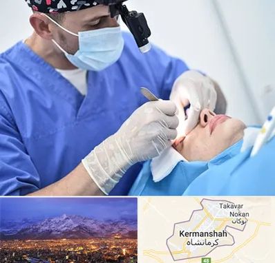 جراح سرطان چشم در کرمانشاه