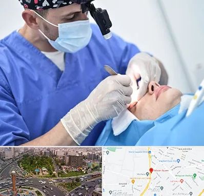 جراح سرطان چشم در سبلان 