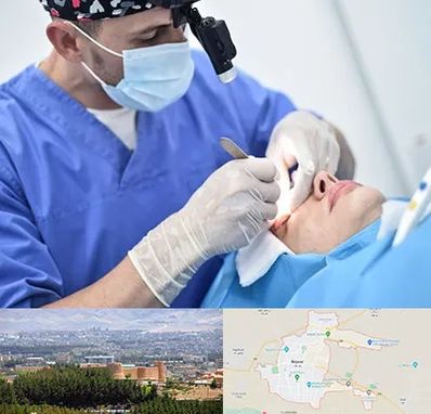 جراح سرطان چشم در بیرجند
