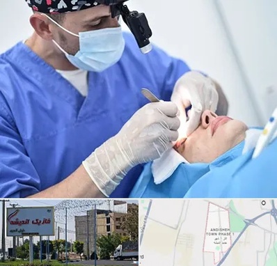 جراح سرطان چشم در فاز یک اندیشه