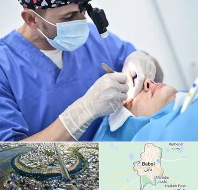 جراح سرطان چشم در بابل
