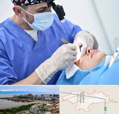 جراح سرطان چشم در بندر ترکمن