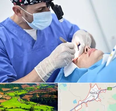 جراح سرطان چشم در نکا