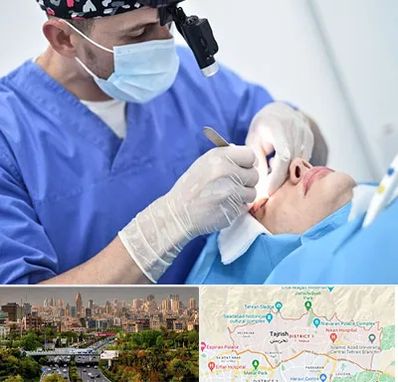 جراح سرطان چشم در منطقه 1 تهران 