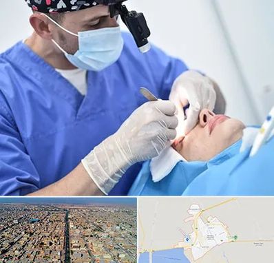 جراح سرطان چشم در بندر ماهشهر