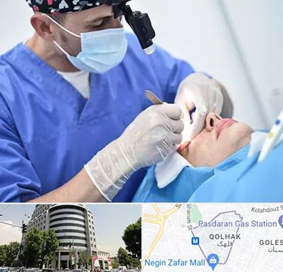 جراح سرطان چشم در قلهک 