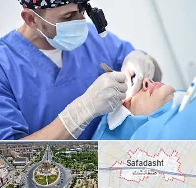 جراح سرطان چشم در صفادشت