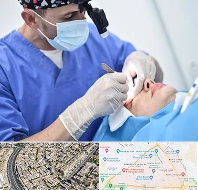 جراح سرطان چشم در شهرک غرب مشهد 