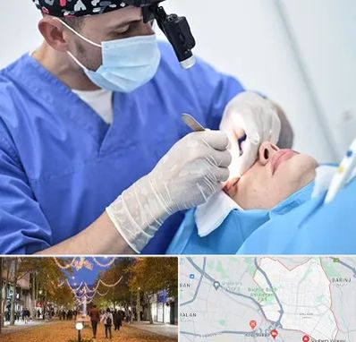 جراح سرطان چشم در ولیعصر ارومیه