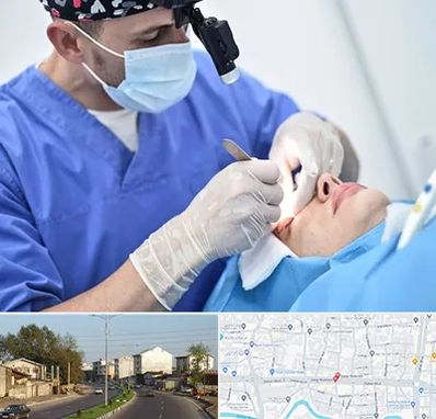 جراح سرطان چشم در ضیابری رشت 