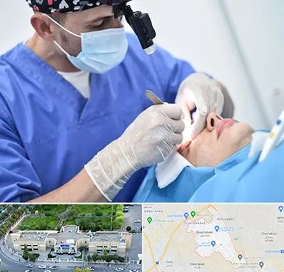 جراح سرطان چشم در نسیم شهر