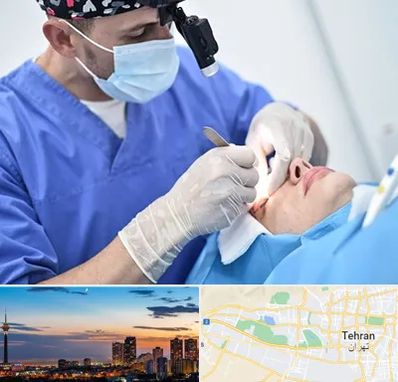 جراح سرطان چشم در غرب تهران 