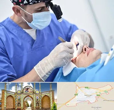 جراح سرطان چشم در سمنان