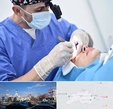 جراح سرطان چشم در ماهدشت کرج 