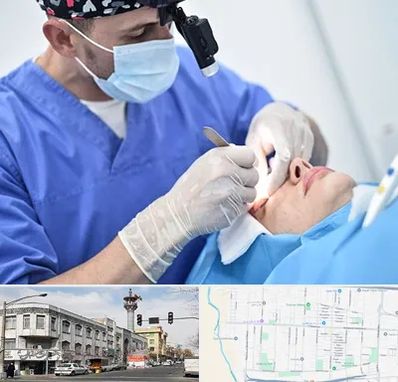 جراح سرطان چشم در 17شهریور