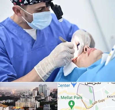 جراح سرطان چشم در الهیه 