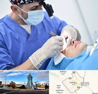 جراح سرطان چشم در تایباد