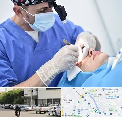 جراح سرطان چشم در قدوسی شرقی شیراز 