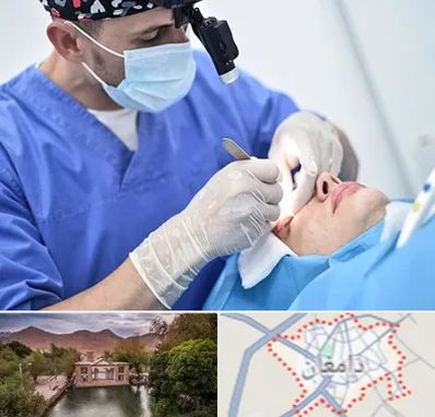 جراح سرطان چشم در دامغان