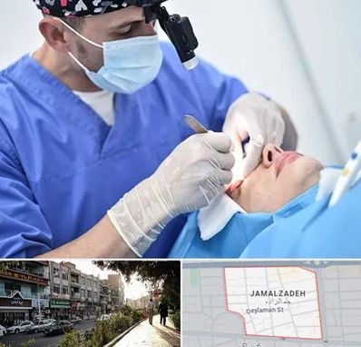 جراح سرطان چشم در خیابان جمالزاده