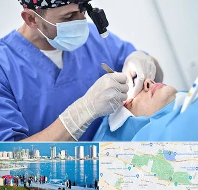 جراح سرطان چشم در چیتگر 