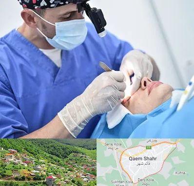 جراح سرطان چشم در قائم شهر