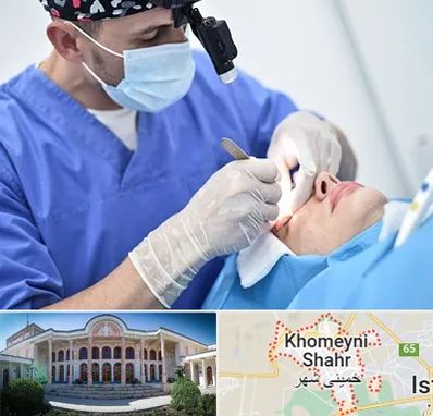 جراح سرطان چشم در خمینی شهر