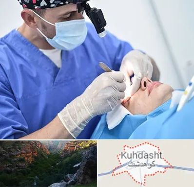جراح سرطان چشم در کوهدشت