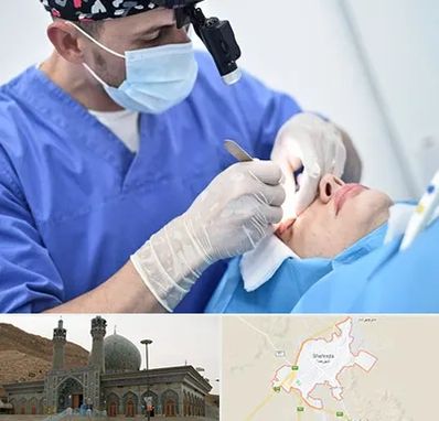 جراح سرطان چشم در شهرضا
