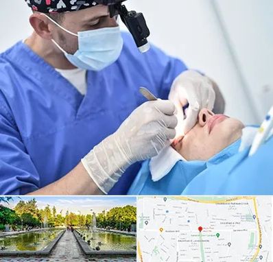 جراح سرطان چشم در سرسبز 