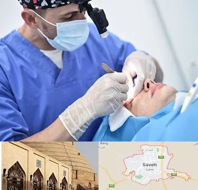 جراح سرطان چشم در ساوه