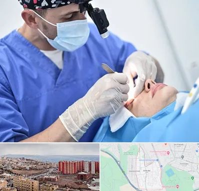 جراح سرطان چشم در سهند تبریز