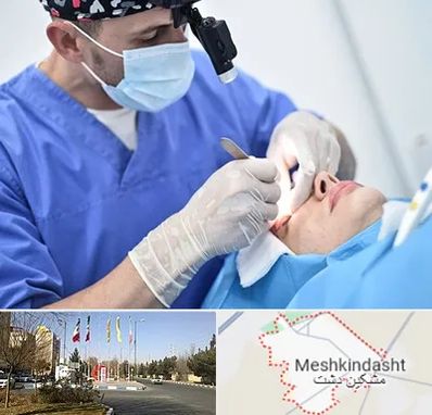 جراح سرطان چشم در مشکین دشت